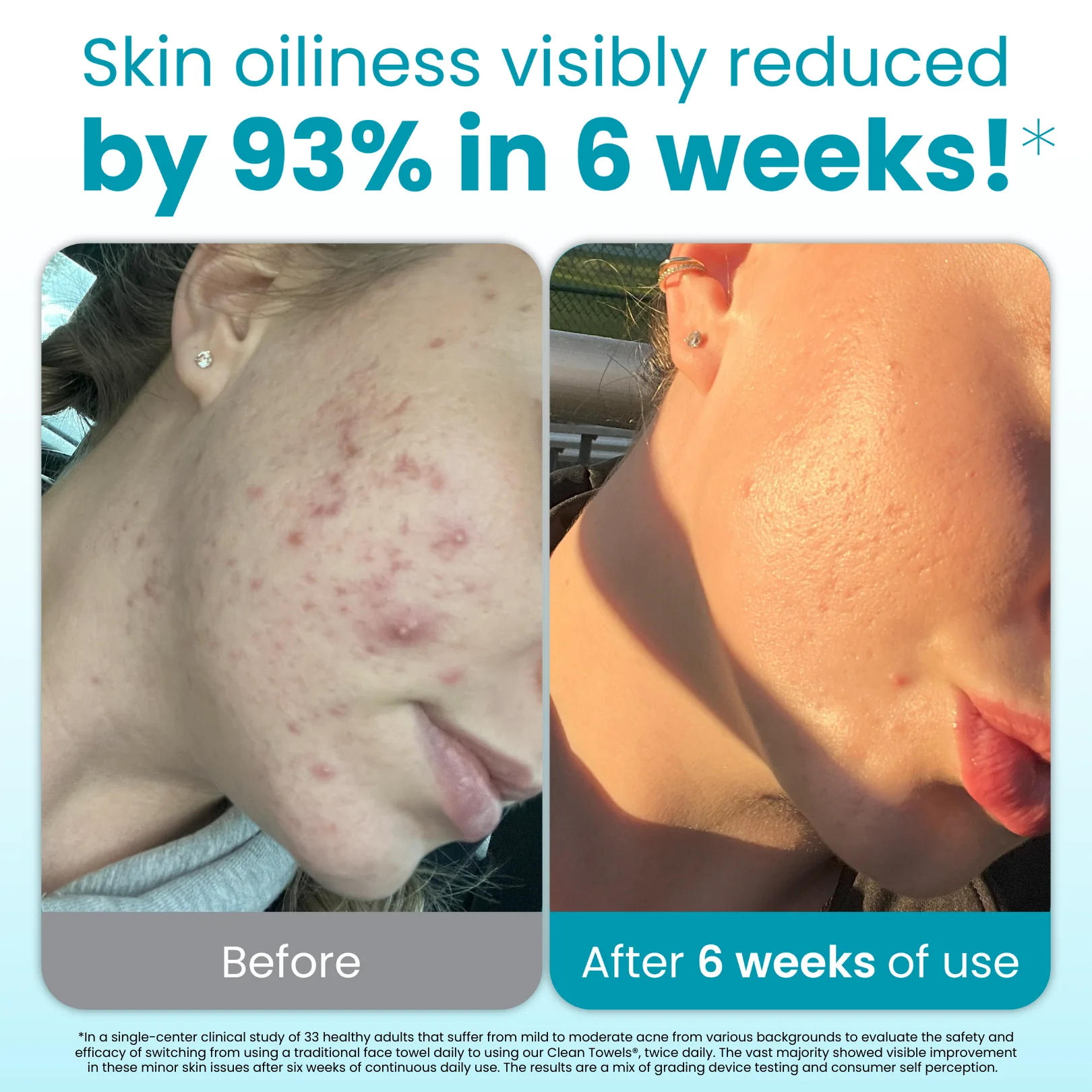 Clean Towels Blemish Control Subscription - Image 2